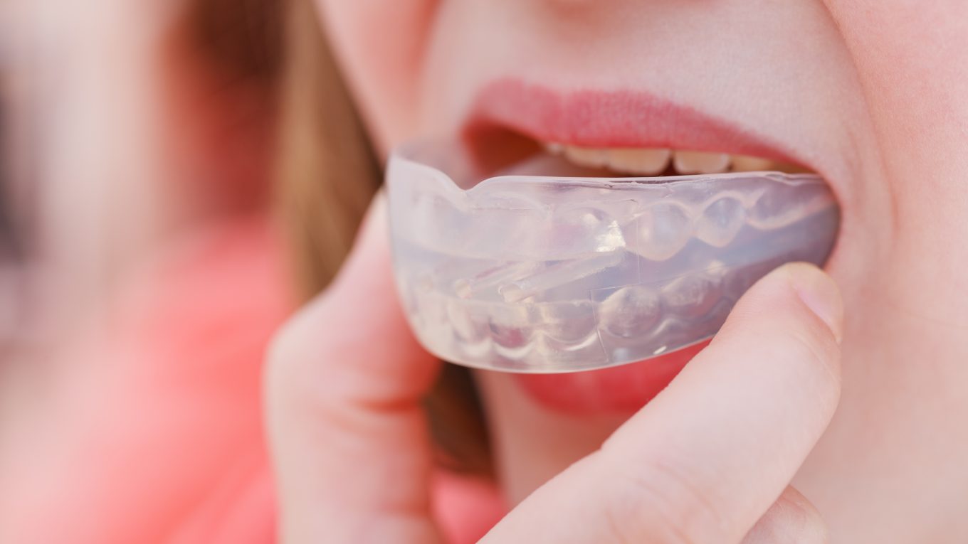 Odontologia esportiva: Use um protetor bucal e proteja seus dentes!